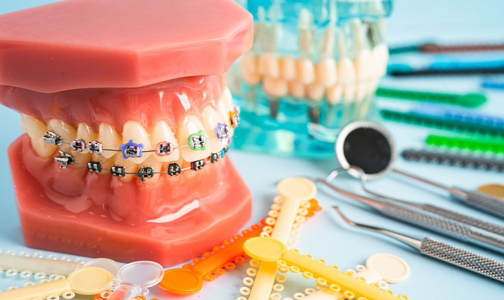 Jibla Dental Center - Orthodontics